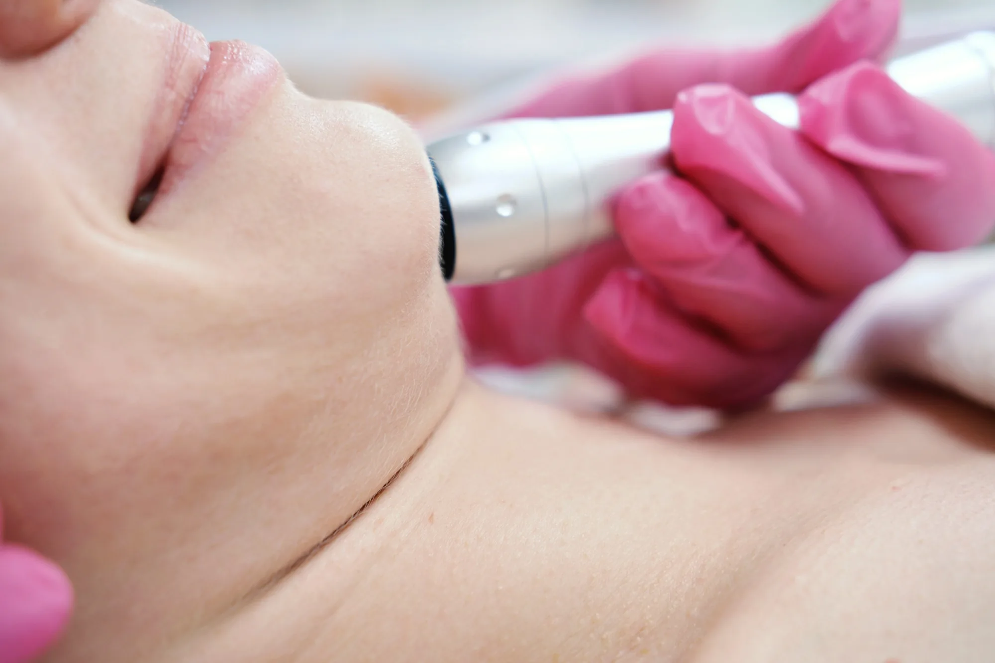 Close-up of a hand in a pink glove applying a skincare wand to a woman's jawline
